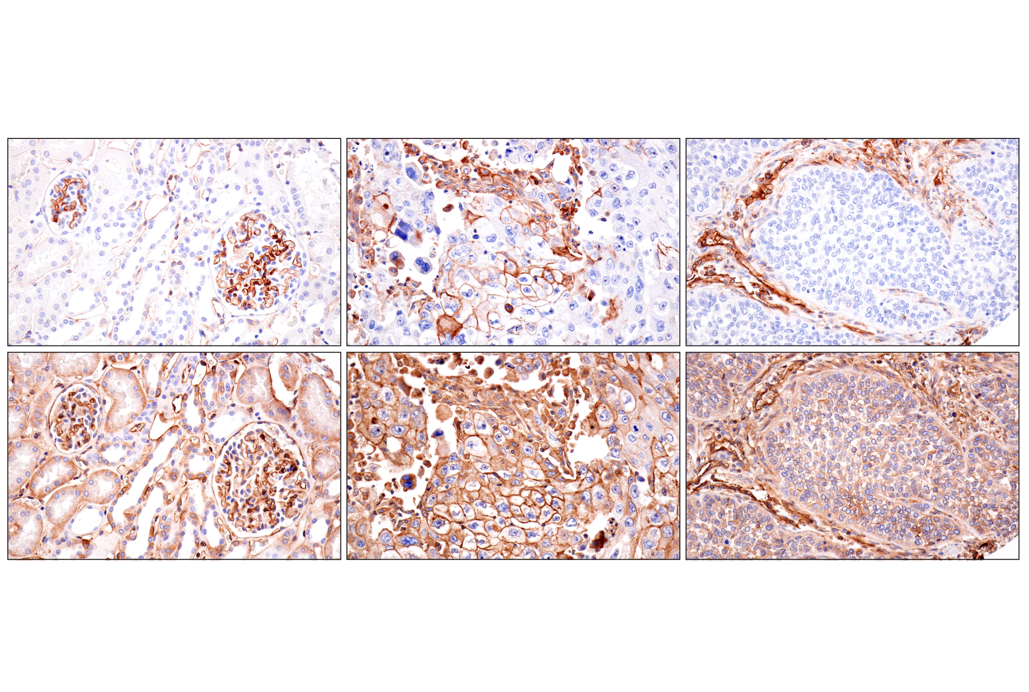 Immunohistochemistry Image 5: HLA-B (BC43) Mouse mAb