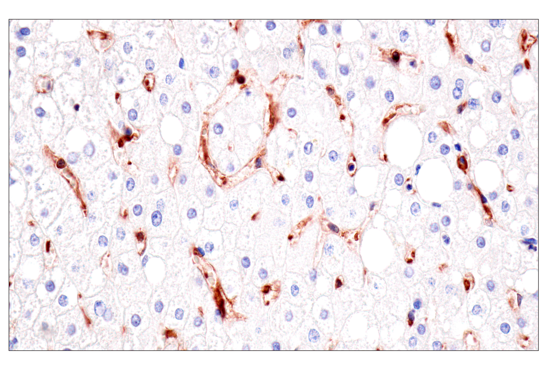 Immunohistochemistry Image 8: HLA-B (BC43) Mouse mAb