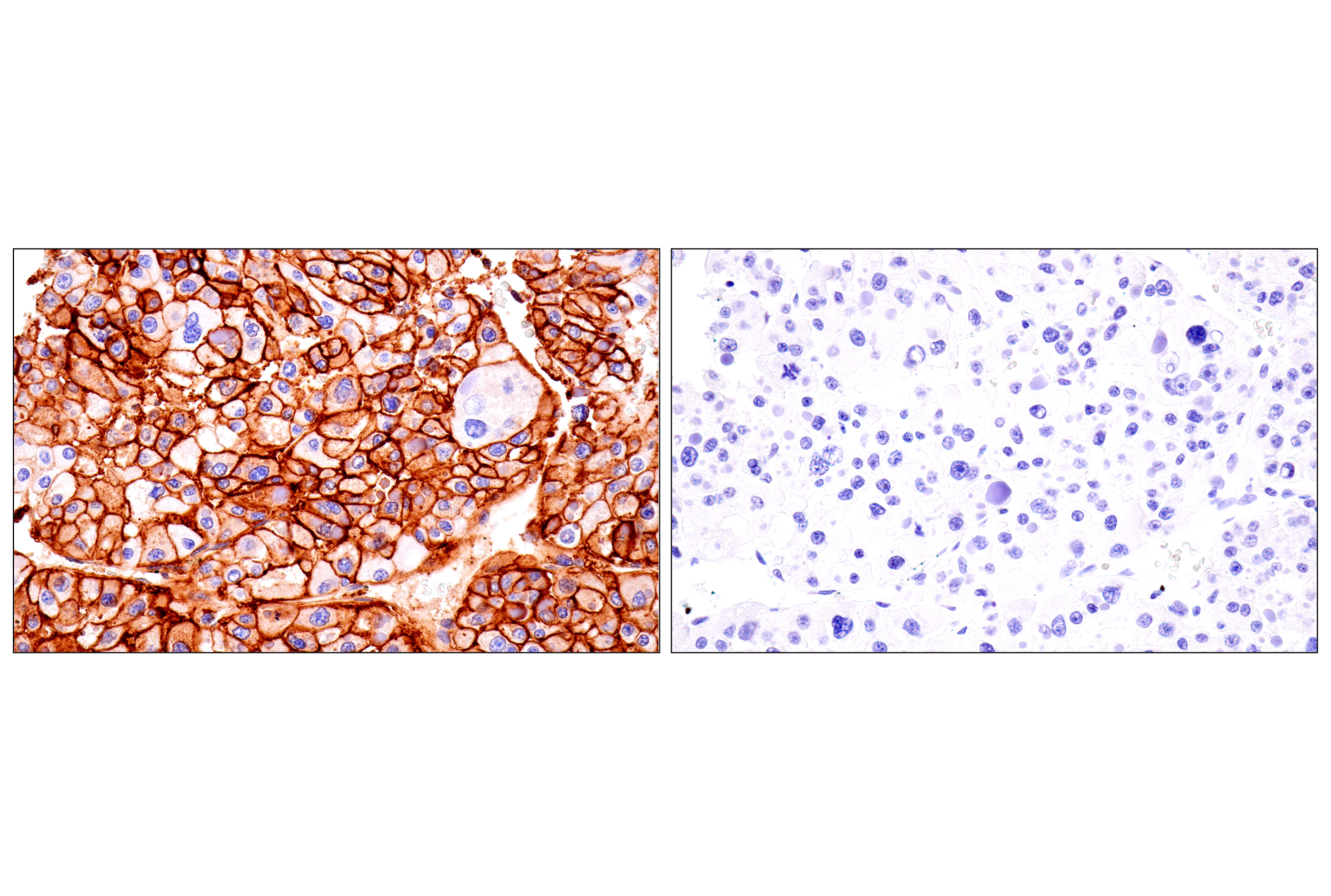 Immunohistochemistry Image 10: HLA-B (BC43) Mouse mAb