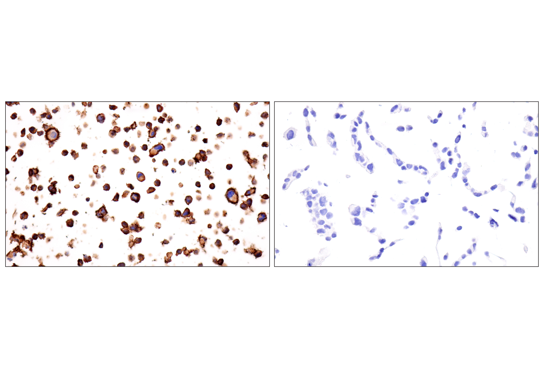 Immunohistochemistry Image 11: HLA-B (BC43) Mouse mAb