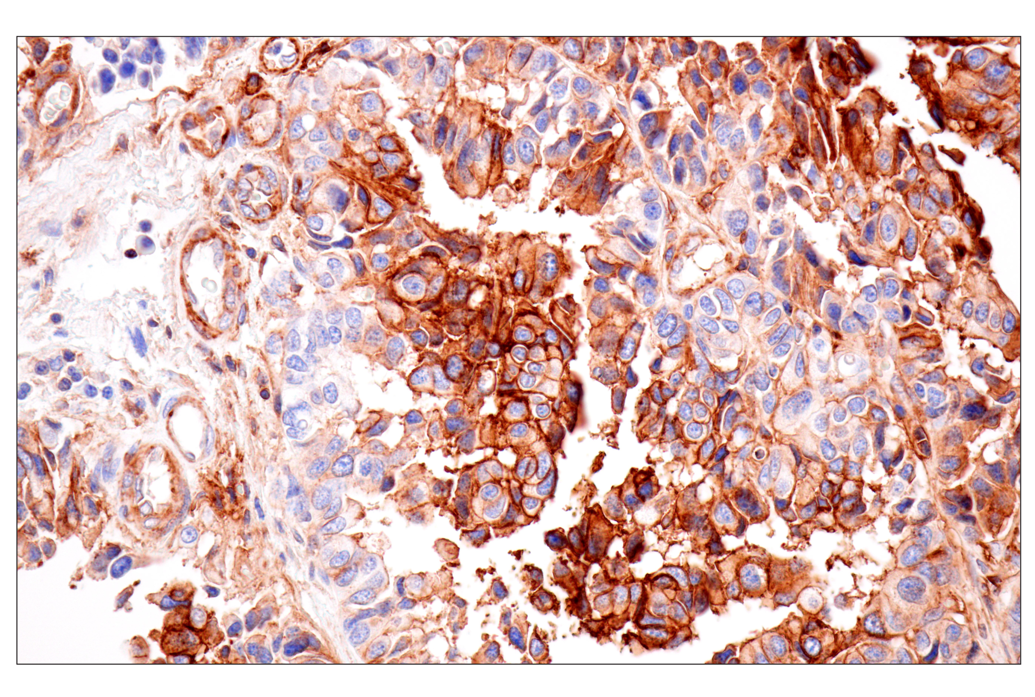 Immunohistochemistry Image 3: HLA-B (BC43) Mouse mAb