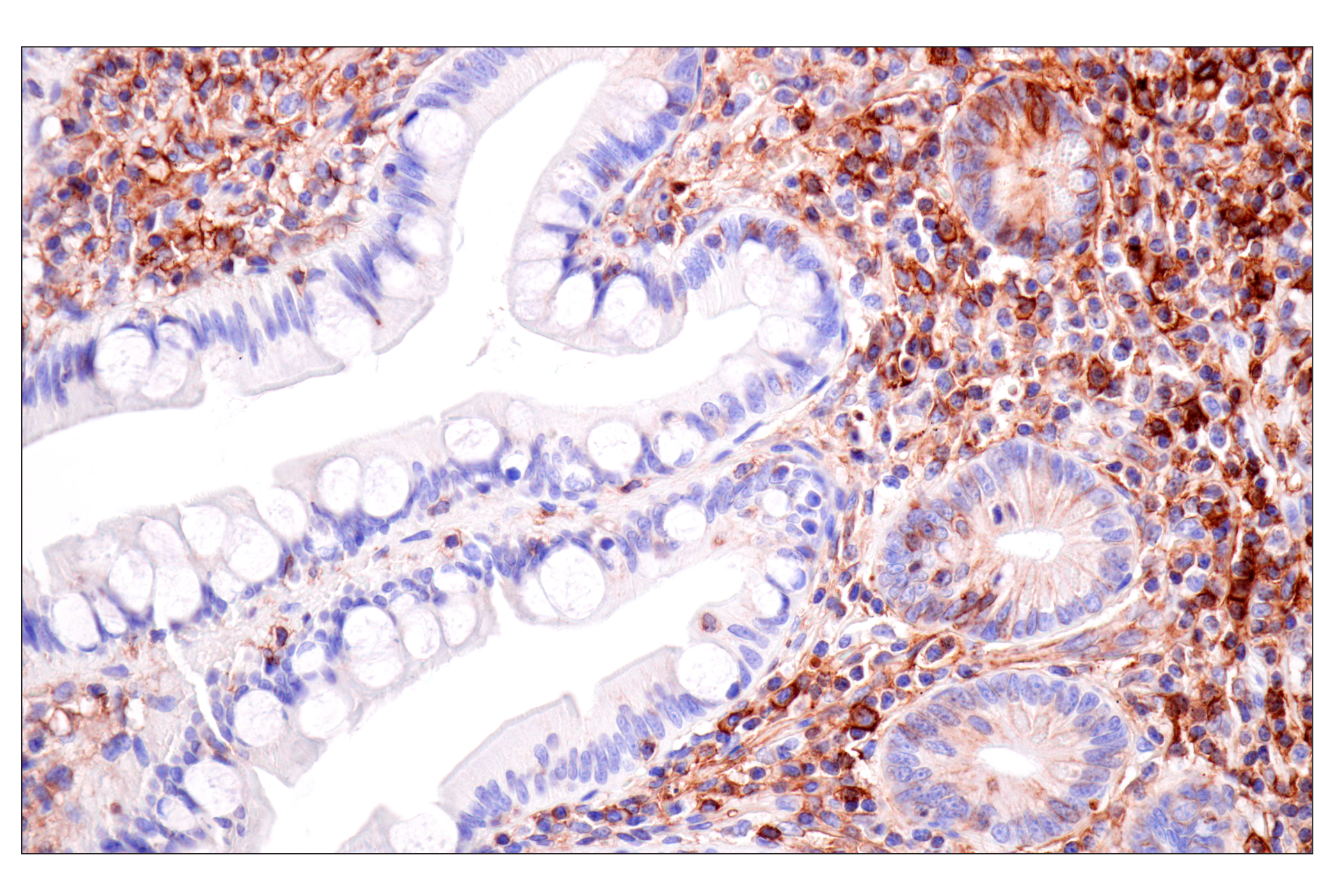 Immunohistochemistry Image 9: HLA-B (BC43) Mouse mAb