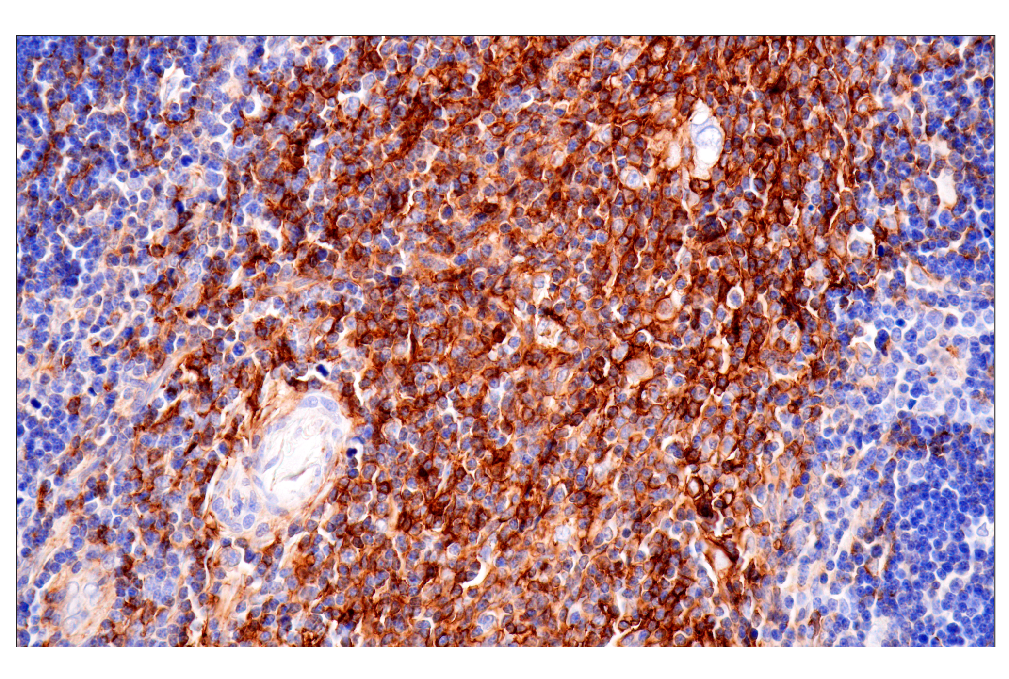 Immunohistochemistry Image 7: HLA-B (BC43) Mouse mAb