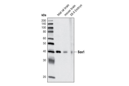 Western Blotting Image 1: Sox1 Antibody