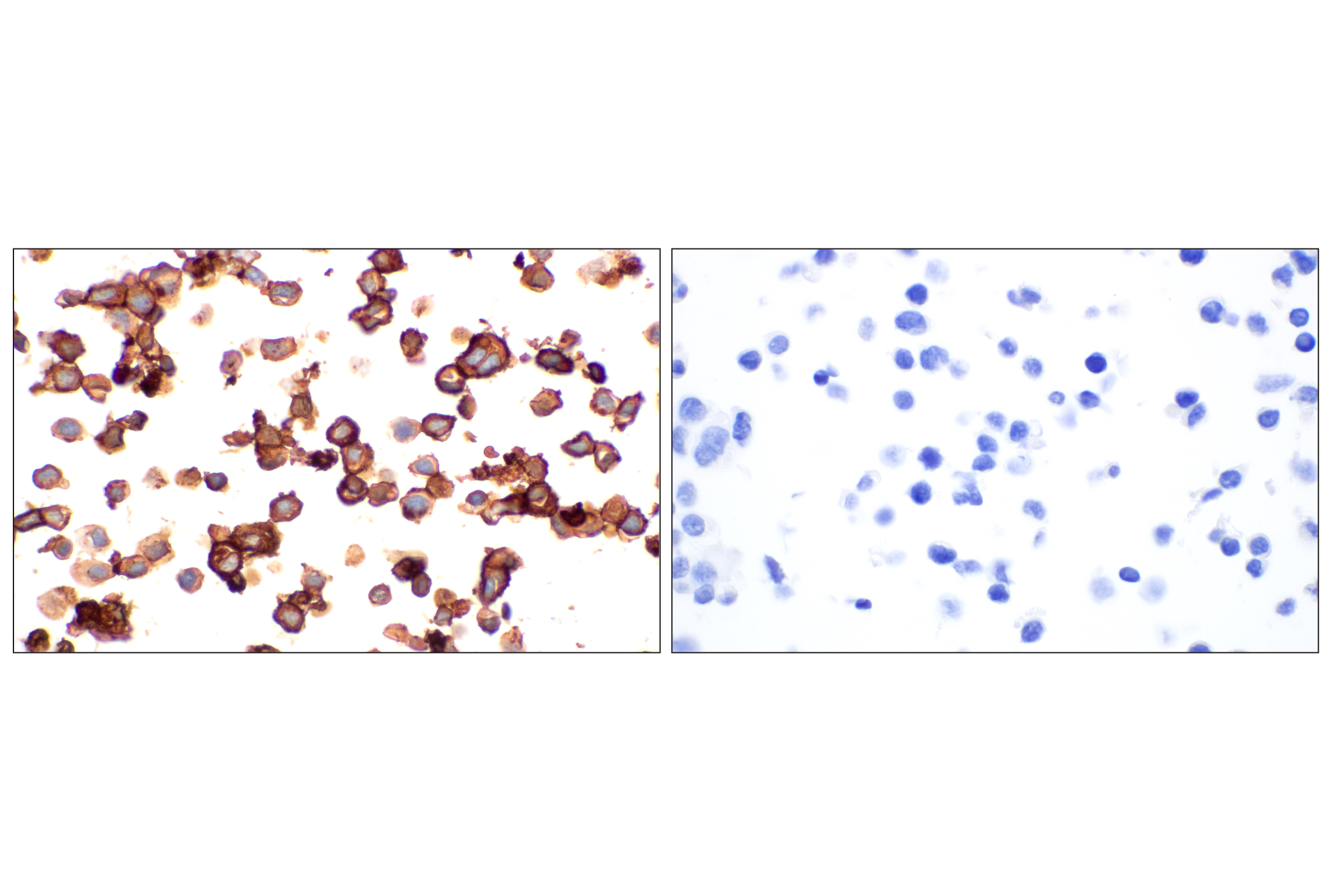 Immunohistochemistry Image 7: MAdCAM-1 (E1V8F) Rabbit mAb (BSA and Azide Free)