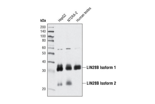 antibodies are used for northern blot analysis