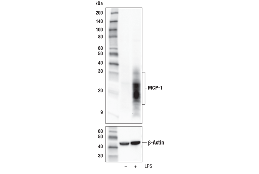  Image 6: Mouse Reactive Senescence Associated Secretory Phenotype (SASP) Antibody Sampler Kit