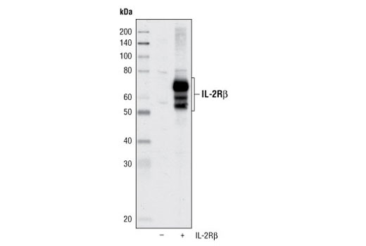 Western Blotting Image 1: IL-2Rβ Antibody