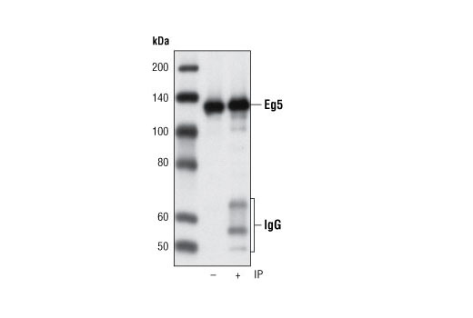Immunoprecipitation Image 1: Eg5 (4H3-1F12) Mouse mAb