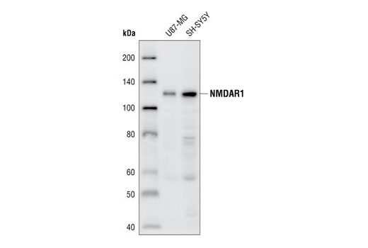 Western Blotting Image 1: NMDAR1 Antibody