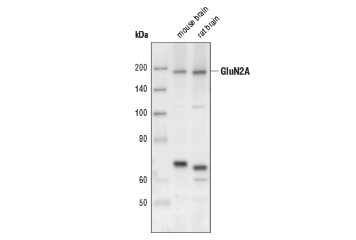 Western Blotting Image 1: NMDA Receptor 2A (GluN2A) Antibody