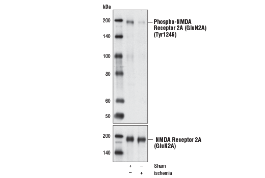Western Blotting Image 1: Phospho-NMDA Receptor 2A (GluN2A) (Tyr1246) Antibody
