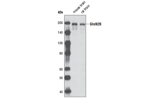 Western Blotting Image 1: NMDA Receptor 2B (GluN2B) Antibody