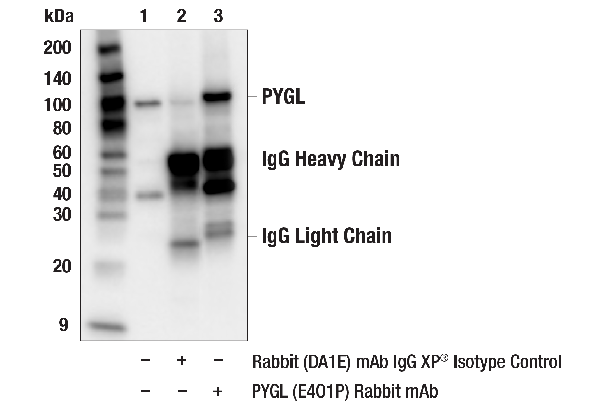 Immunoprecipitation Image 1: PYGL (E4O1P) Rabbit mAb