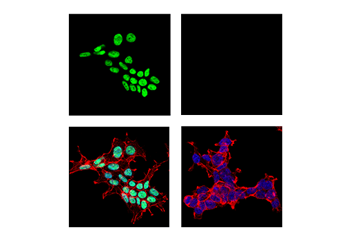 Immunofluorescence Image 1: HDGF (E3P7K) Rabbit mAb