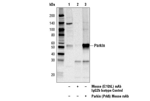 Immunoprecipitation Image 1: Parkin (Prk8) Mouse mAb