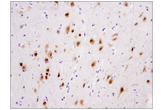 Immunohistochemistry Image 1: TBR1 (D6C6X) Rabbit mAb (BSA and Azide Free)