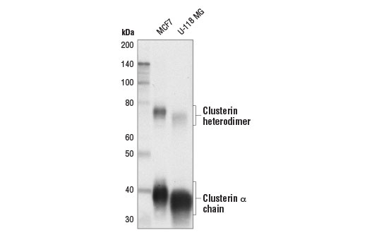 Western Blotting Image 1: Clusterin (D4B6P) Rabbit mAb