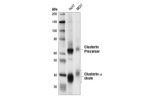 Western Blotting Image 2: Clusterin (D4B6P) Rabbit mAb