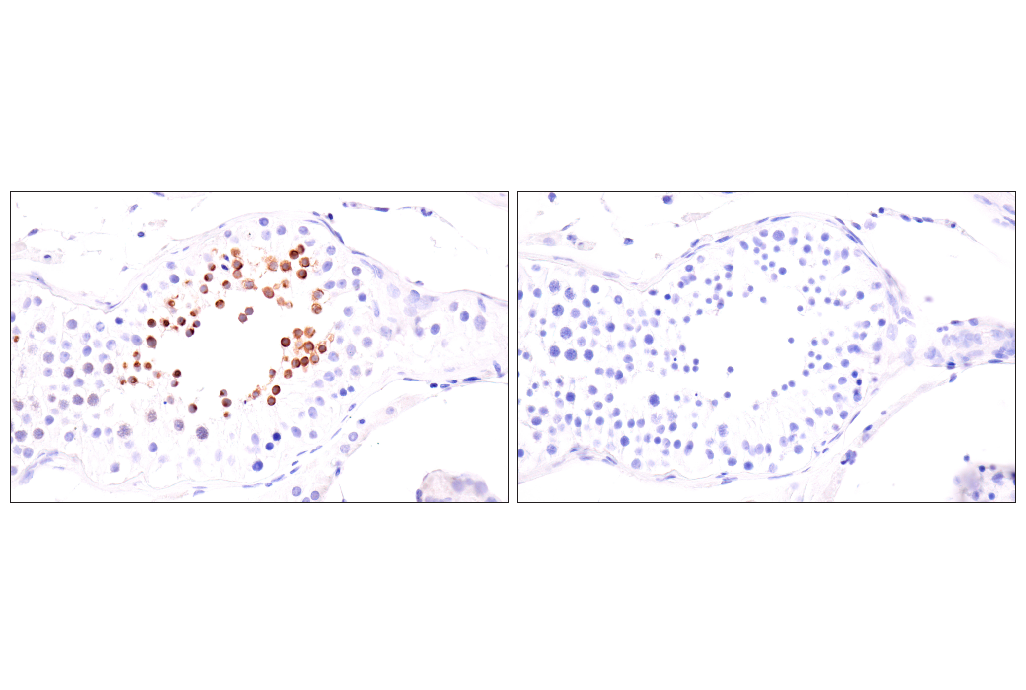 Kiss1 E6h9s Rabbit Mab Cell Signaling Technology 9750