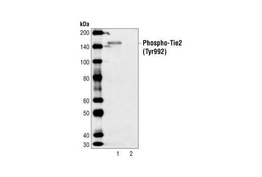 Western Blotting Image 1: Phospho-Tie2 (Tyr992) Antibody