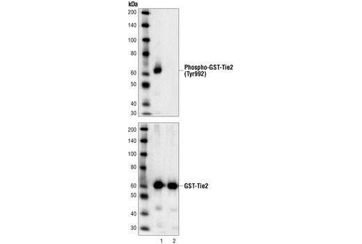 Western Blotting Image 2: Phospho-Tie2 (Tyr992) Antibody