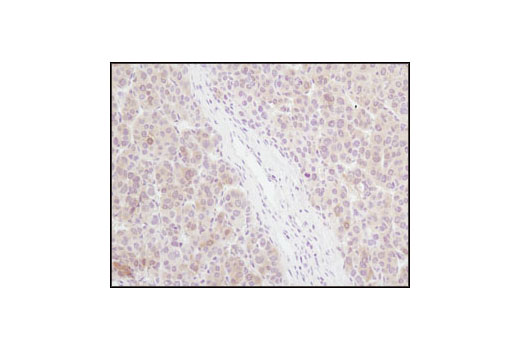 Immunohistochemistry Image 2: 4E-BP1 (53H11) Rabbit mAb (BSA and Azide Free)