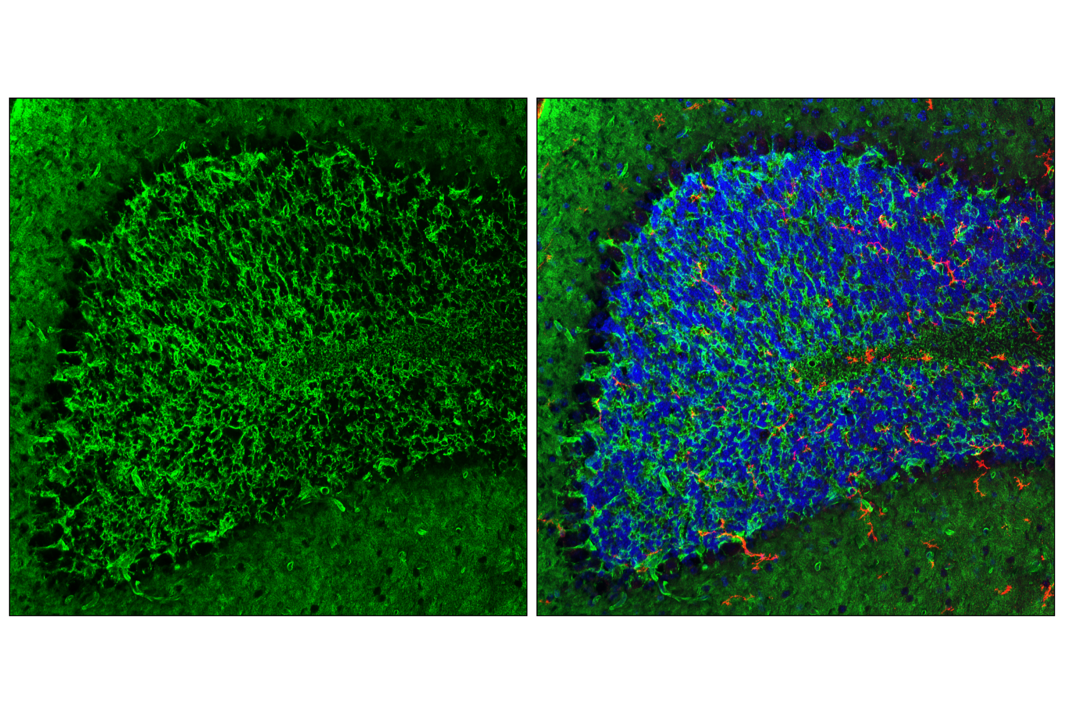 Immunofluorescence Image 1: AQP4 (E8W5A) Mouse mAb