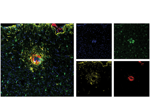 Immunofluorescence Image 1: β-Amyloid (D54D2) XP® Rabbit mAb (Alexa Fluor® 647 Conjugate)