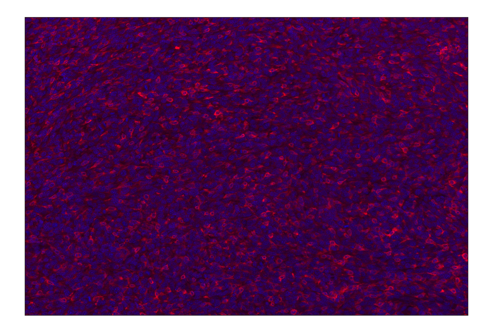 Immunohistochemistry Image 1: CD11b/ITGAM (E4K8C) Rabbit mAb (Alexa Fluor® 647 Conjugate)