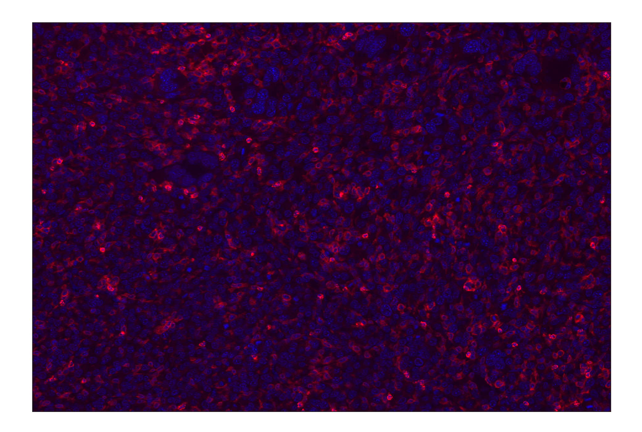 Immunohistochemistry Image 2: CD11b/ITGAM (E4K8C) Rabbit mAb (Alexa Fluor® 647 Conjugate)