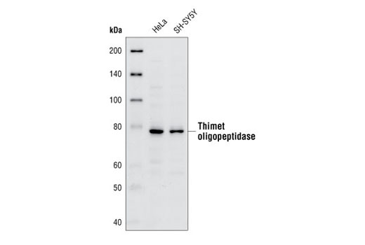 Western Blotting Image 1: Thimet oligopeptidase (IVD6) Mouse mAb