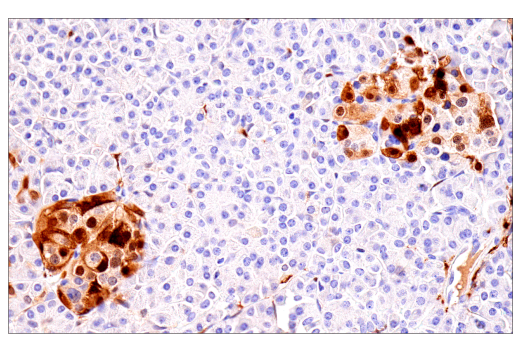 Immunohistochemistry Image 1: S100B (E7C3A) Rabbit mAb (BSA and Azide Free)