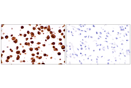 Immunohistochemistry Image 2: S100B (E7C3A) Rabbit mAb (BSA and Azide Free)