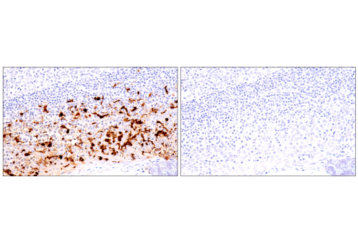 Immunohistochemistry Image 3: S100B (E7C3A) Rabbit mAb (BSA and Azide Free)