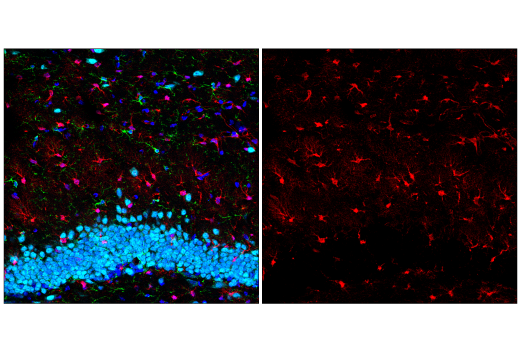 Immunofluorescence Image 2: S100B (E7C3A) Rabbit mAb (BSA and Azide Free)