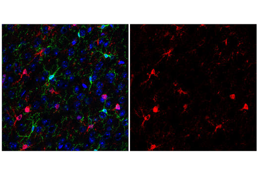 Immunofluorescence Image 3: S100B (E7C3A) Rabbit mAb (BSA and Azide Free)