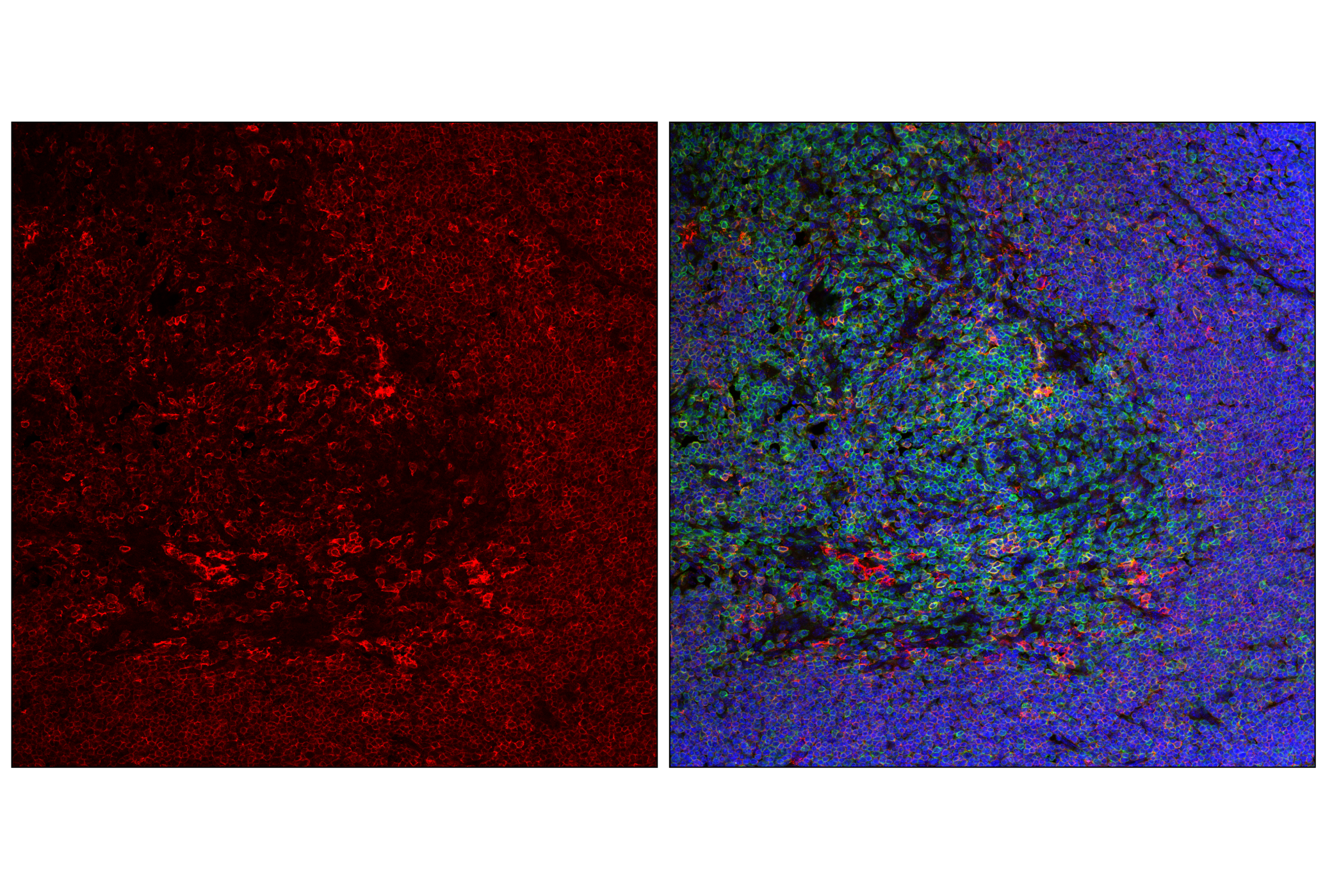 Immunofluorescence Image 2: SLAMF6/Ly108 (E2P7A) Rabbit mAb (Alexa Fluor® 647 Conjugate)