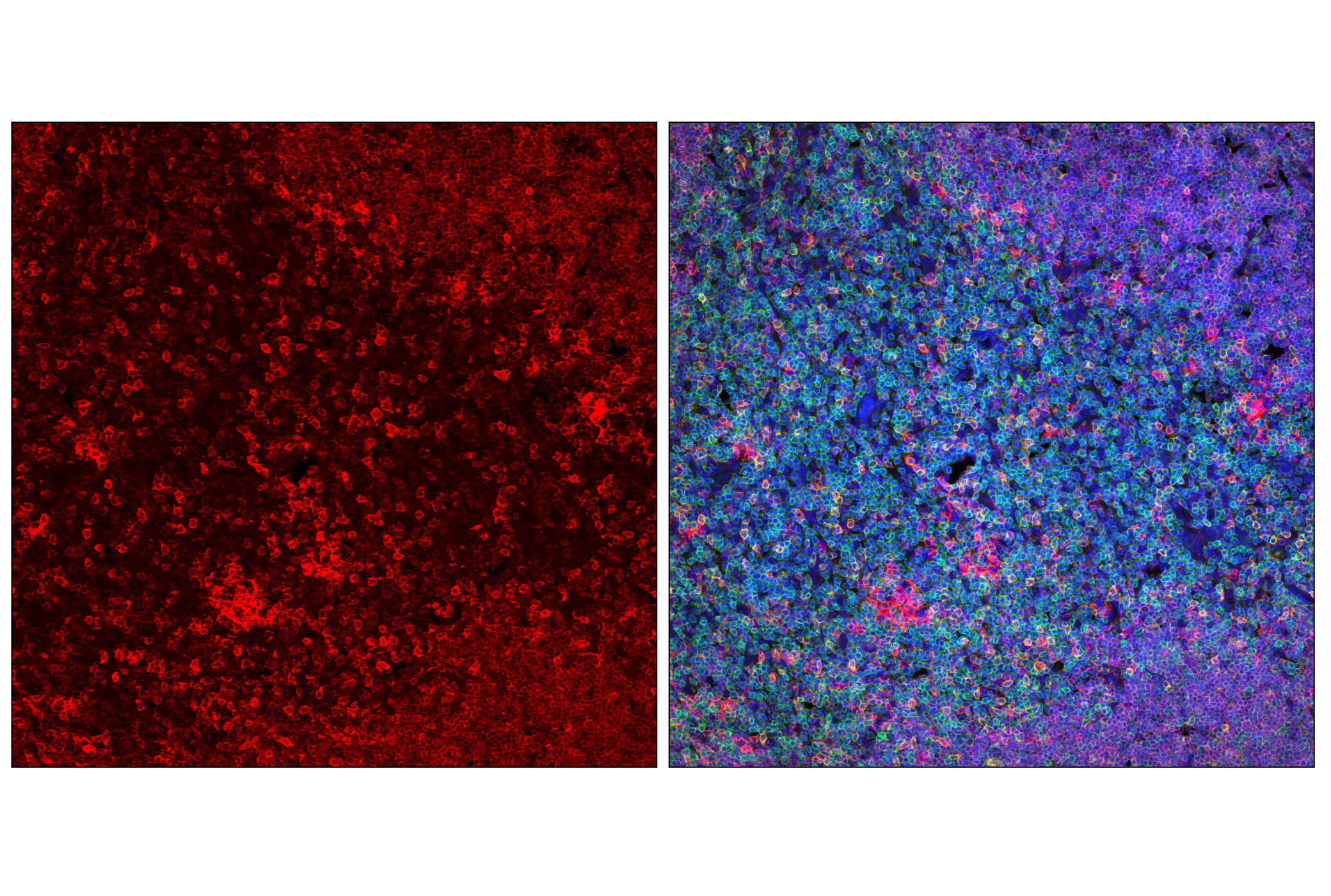 Immunofluorescence Image 1: SLAMF6/Ly108 (E2P7A) Rabbit mAb (Alexa Fluor® 647 Conjugate)