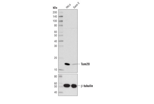  Image 4: Mitochondrial Dynamics Antibody Sampler Kit II