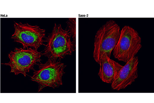 Immunofluorescence Image 1: Tom20 (D8T4N) Rabbit mAb
