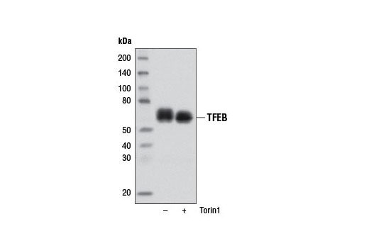Western Blotting Image 1: TFEB Antibody