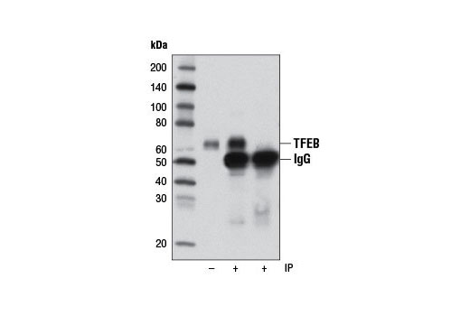 Immunoprecipitation Image 1: TFEB Antibody