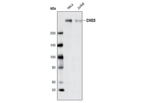 Western Blotting Image 1: CHD3 Antibody