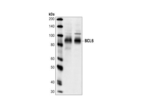 Western Blotting Image 1: BCL6 Antibody