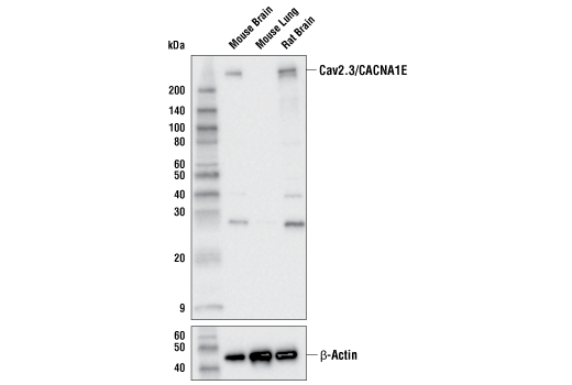 Western Blotting Image 1: Cav2.3/CACNA1E Antibody