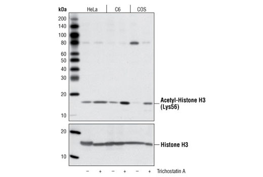  Image 5: Acetyl-Histone H3 Antibody Sampler Kit