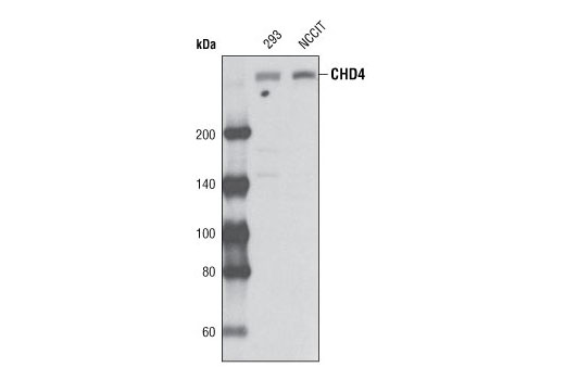 Western Blotting Image 1: CHD4 Antibody