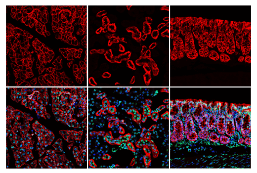 Immunofluorescence Image 1: EpCAM (E8Q1Z) Rabbit mAb (Mouse Preferred)