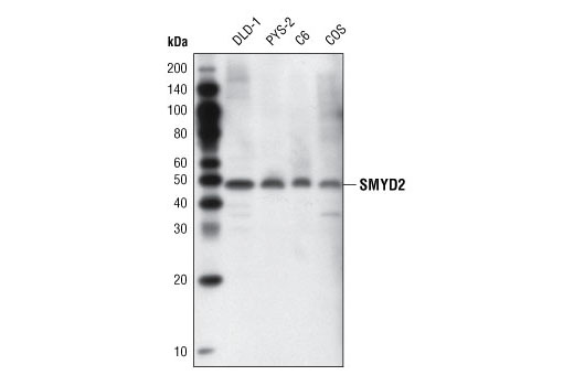 Western Blotting Image 1: SMYD2 Antibody